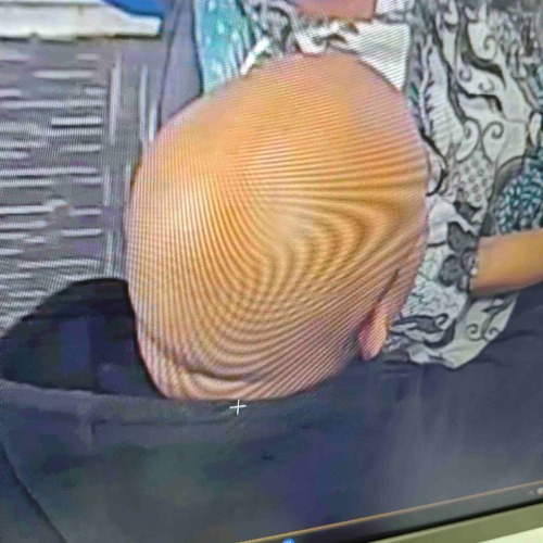 The Baldhead